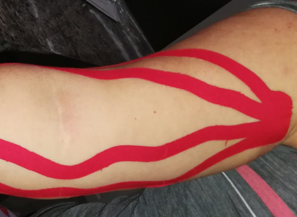 Taping for multi - purpose such as to prevent injuries, support a joint/movements, pain management or even to reduce swelling and improve Lymph flow.